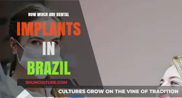 Dental Implants in Brazil: Cost, Quality, and What to Expect