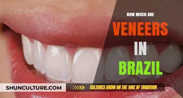 Veneers in Brazil: Cost, Quality, and What to Expect