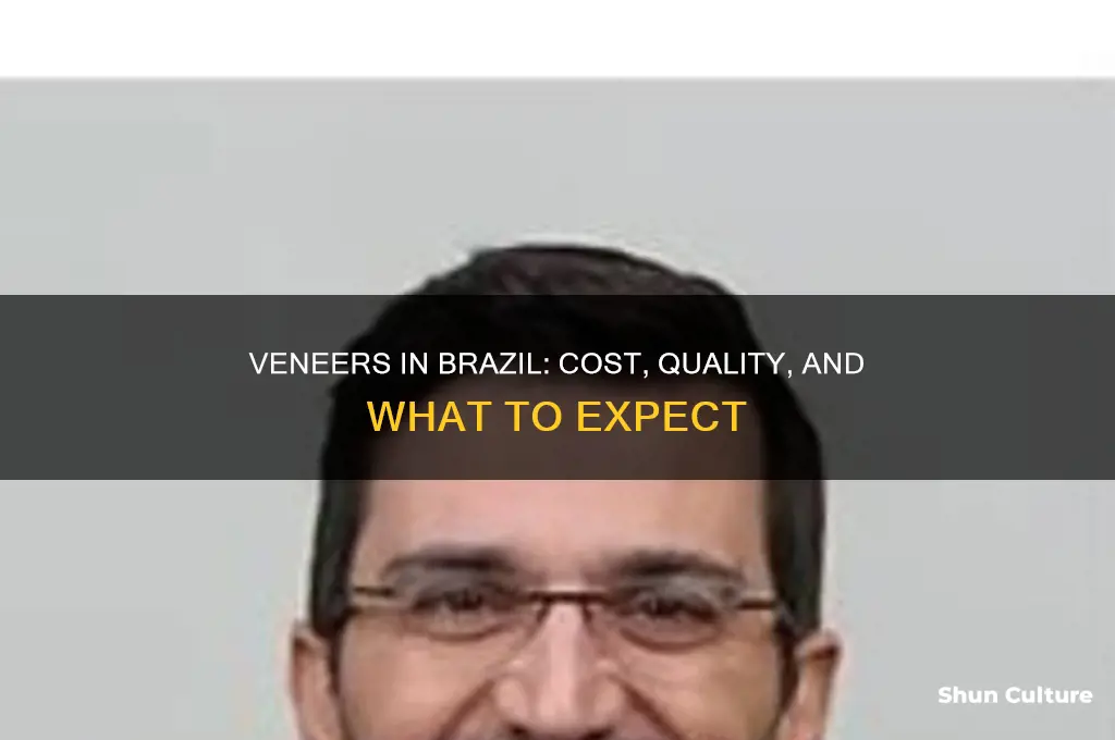 how much are veneers in brazil