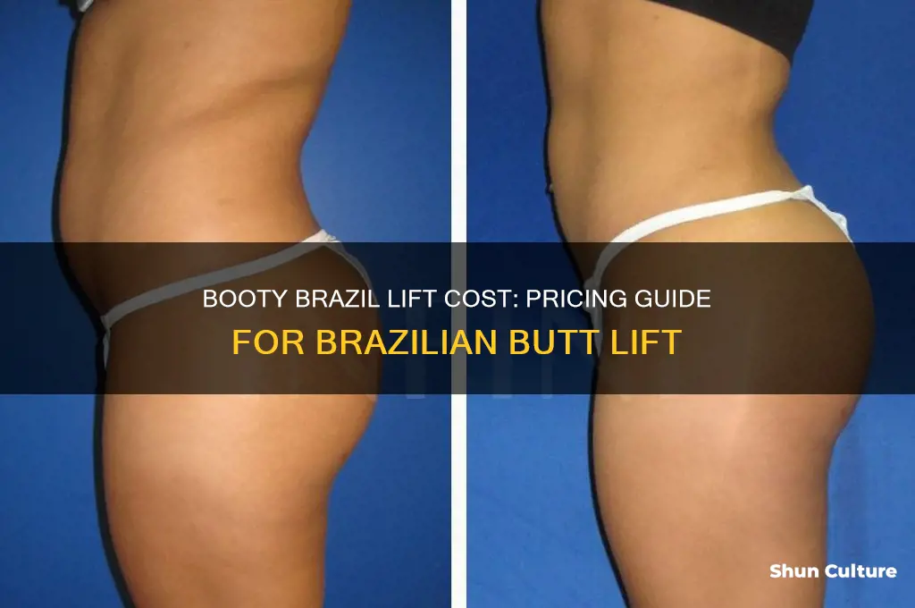 how much does a booty brazil lift cost