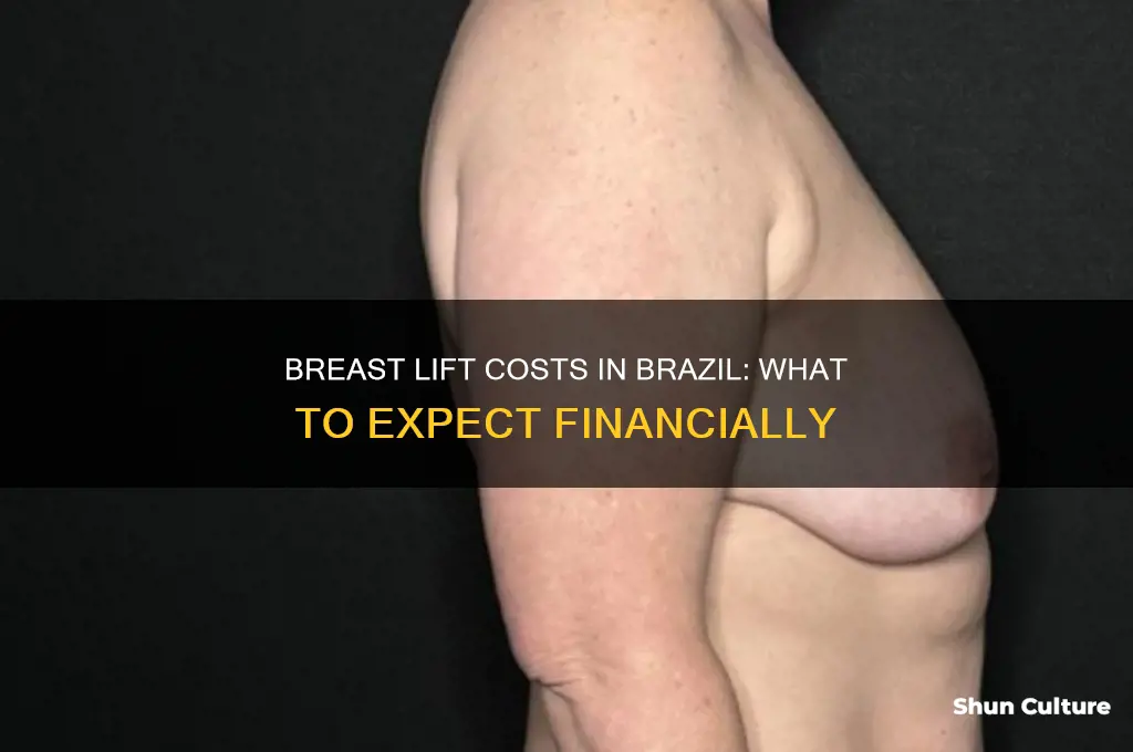 how much does a breast lift cost in brazil