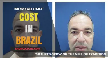 Facelift Costs in Brazil: What to Expect for Your Budget