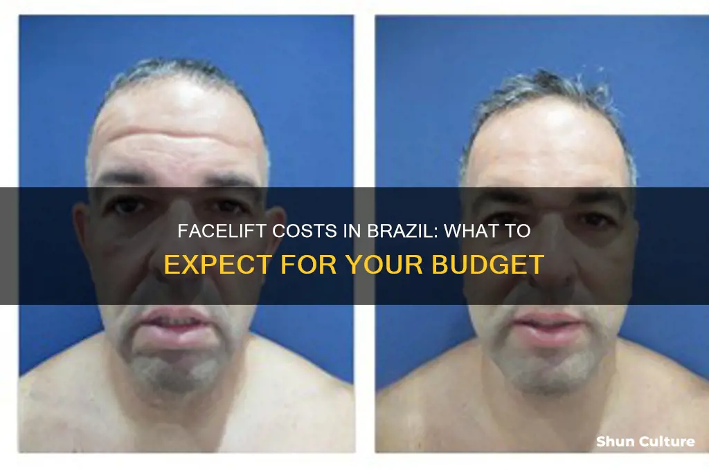 how much does a facelift cost in brazil