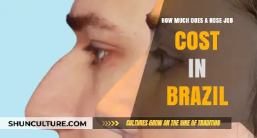 Nose Job Costs in Brazil: What to Expect Financially
