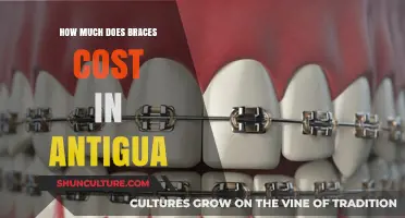 Braces Cost in Antigua: Affordable Orthodontic Treatment Options Revealed