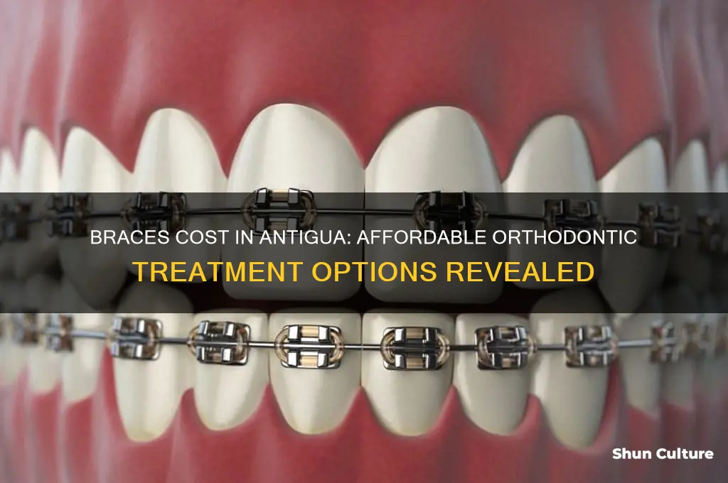 how much does braces cost in antigua