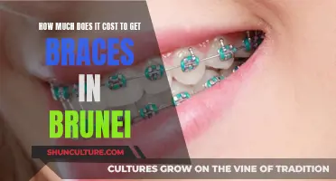 Braces Cost in Brunei: What's the Price for a Perfect Smile?