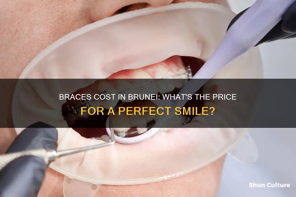 how much does it cost to get braces in brunei