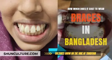 Braces Cost in Bangladesh: Affordable Orthodontic Treatment Options Revealed