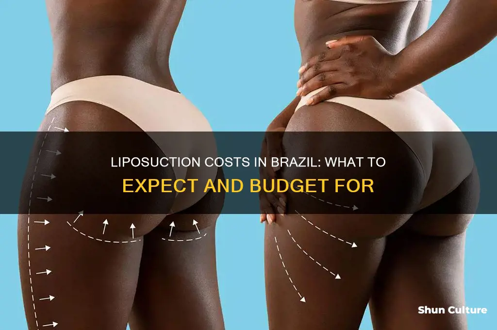 how much does liposuction cost in brazil