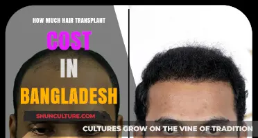 Hair Transplant Cost in Bangladesh: Affordable Solutions for Hair Restoration