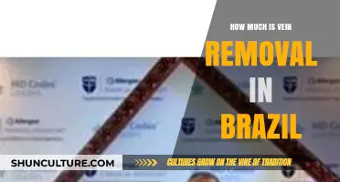 Vein Removal Costs in Brazil: What to Expect Financially