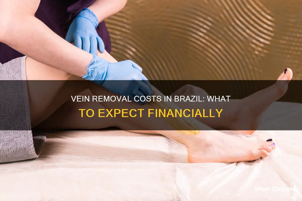 how much is vein removal in brazil