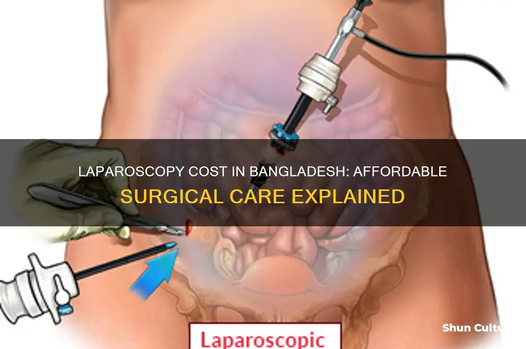 how much laparoscopy cost in bangladesh