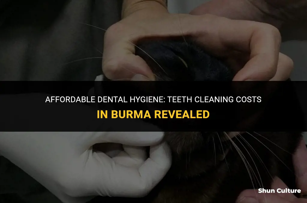 how much to get teeth cleaning in burma