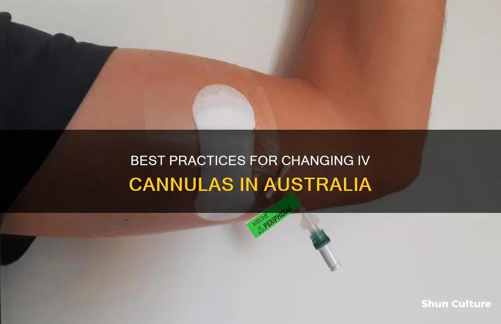 how often should iv cannula be changed australia
