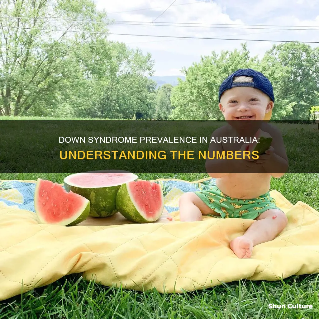 how prevalent is down syndrome in the australian population
