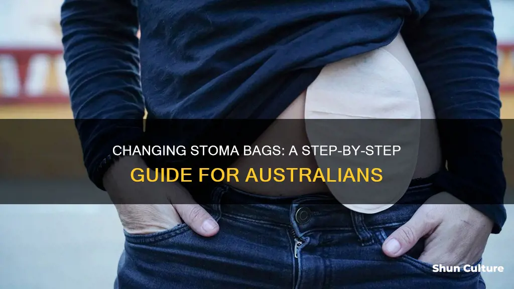 how to change a stoma bag australia