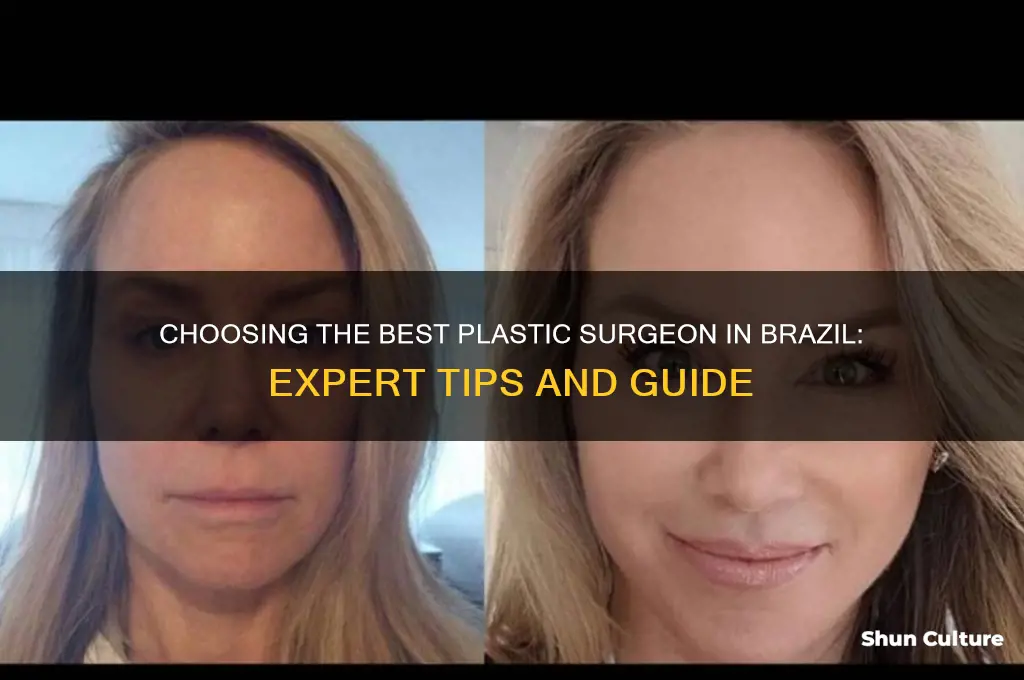 how to find a good plastic surgeon in brazil