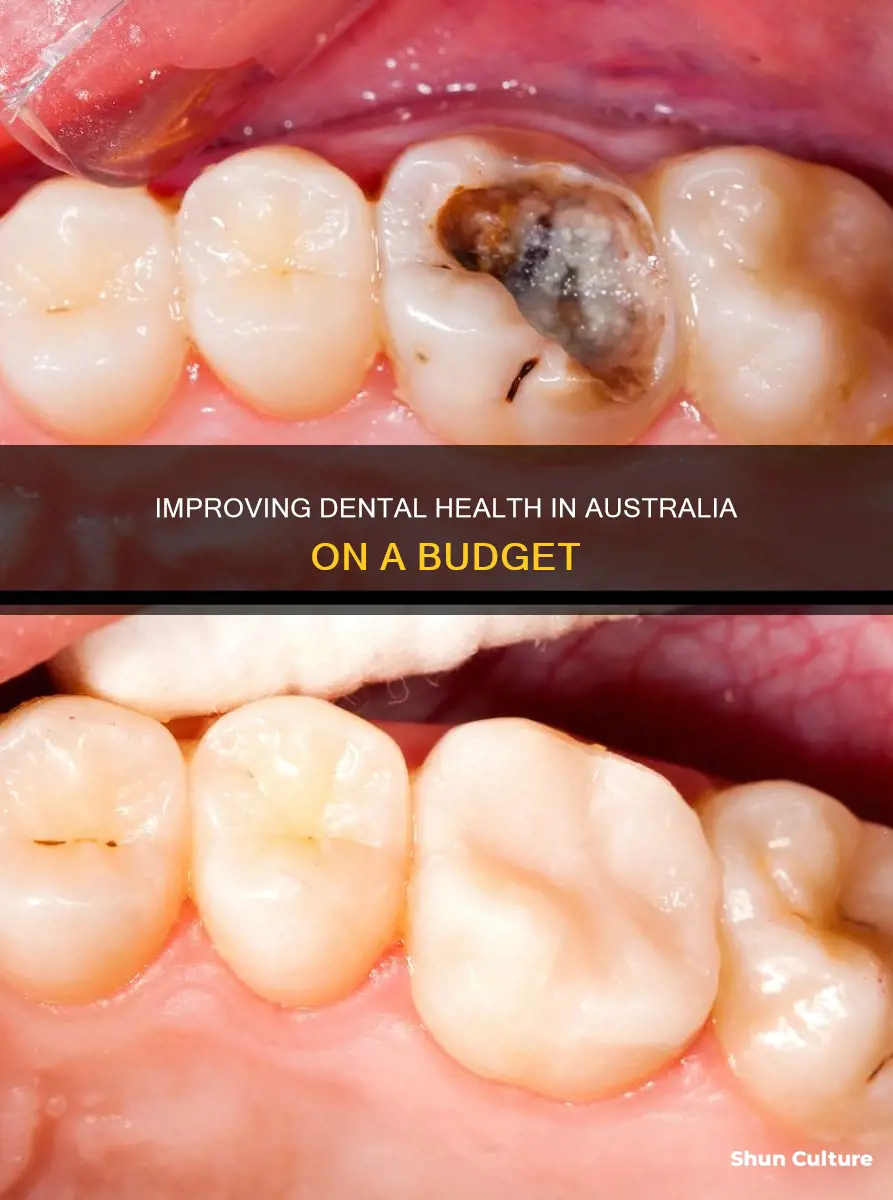 how to fix bad teeth with no money australia