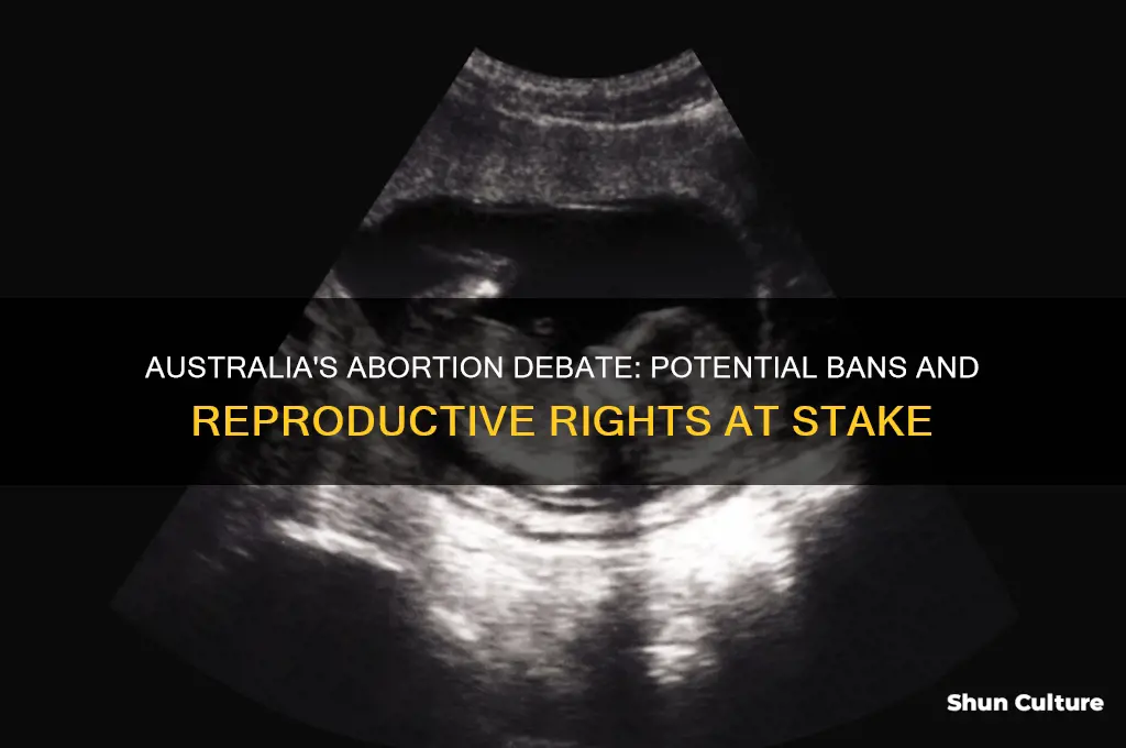 is australia going to ban abortion