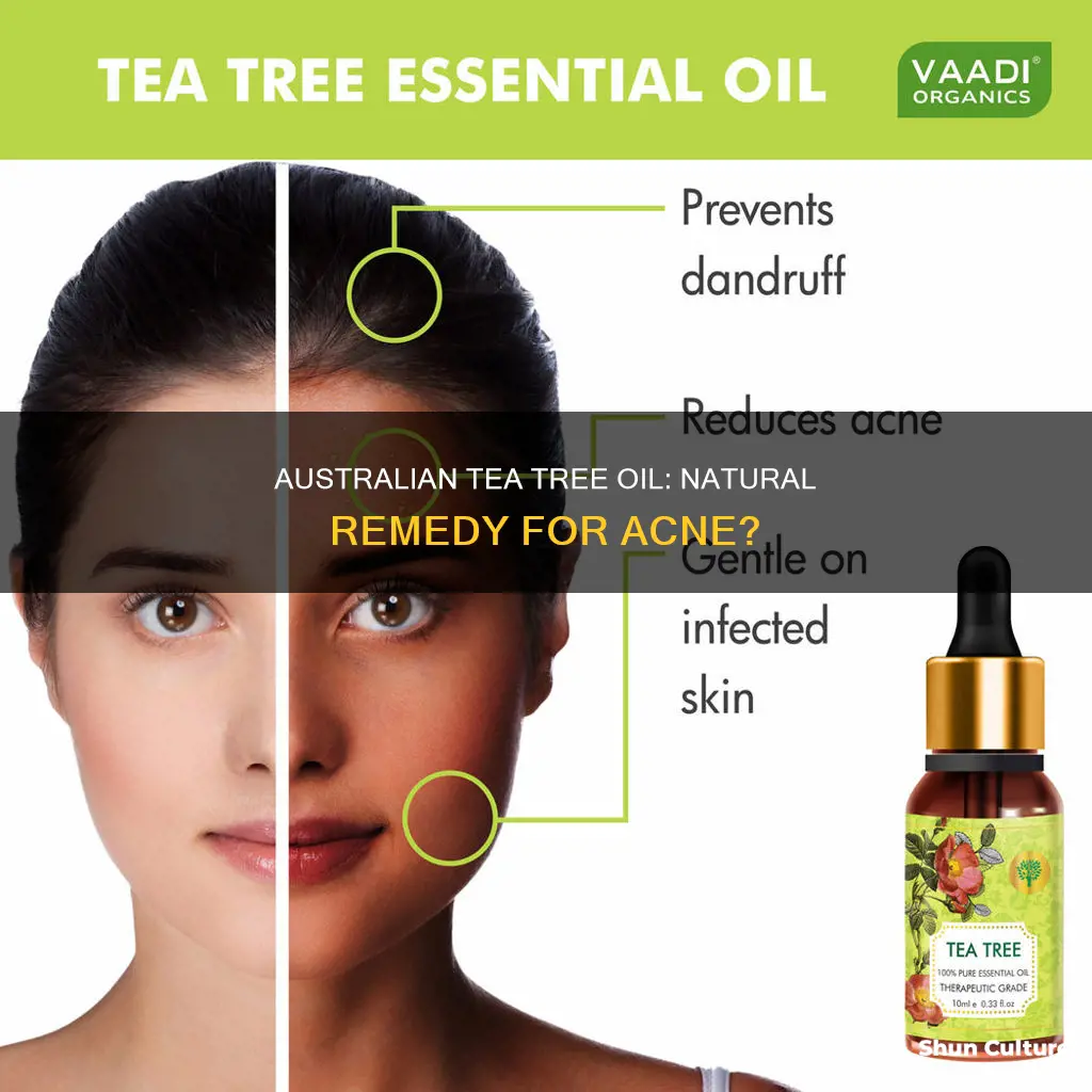 is australian tea tree oil good for acne