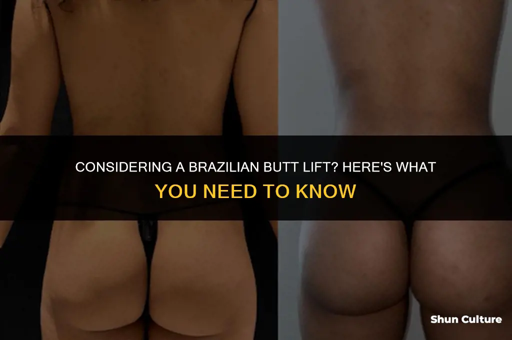 is brazil butt lift right for me