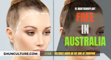 Hair Transplants: Australia's Free Option