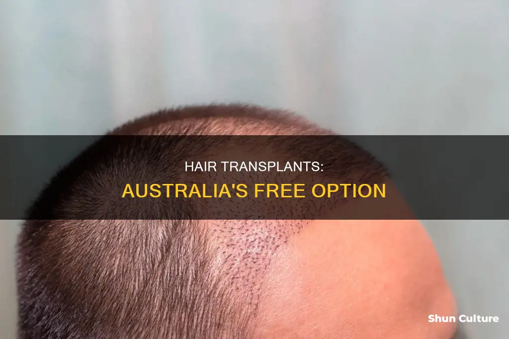 is hairtransplant free in australia