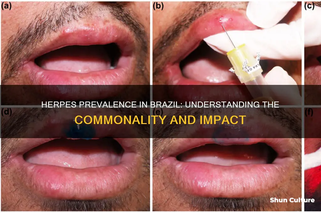 is herpes common in brazil