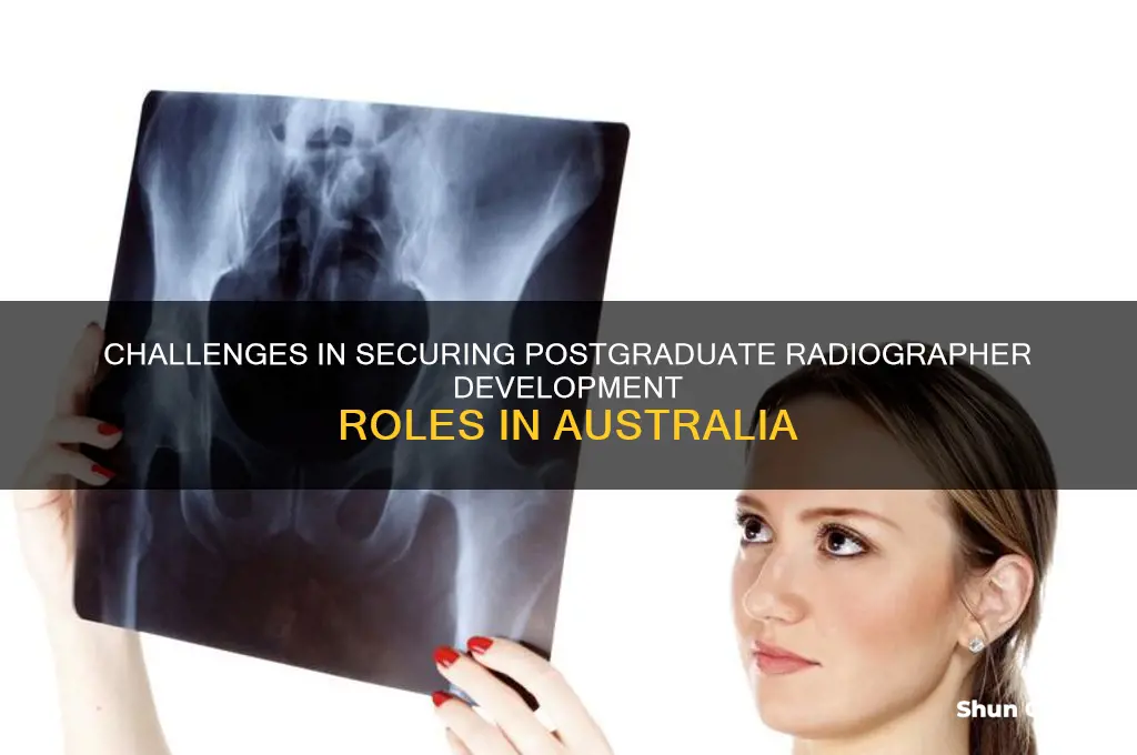 is it hard to find postgraduate development year radiographer australia
