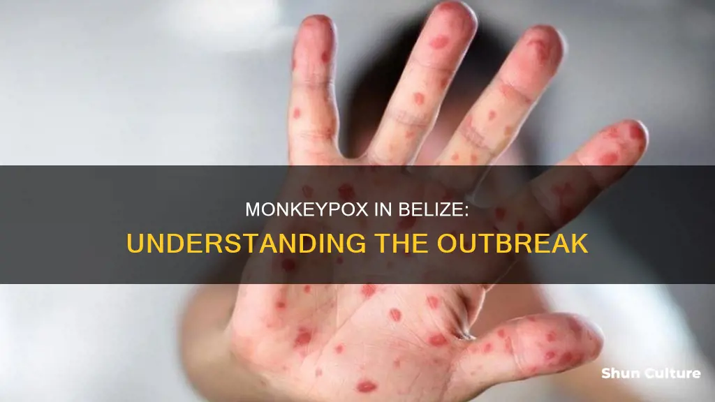 is monkey pox in belize