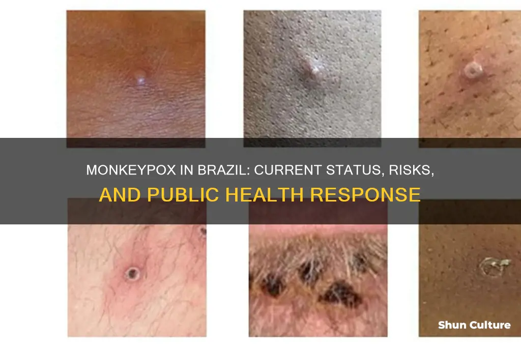 is monkeypox in brazil