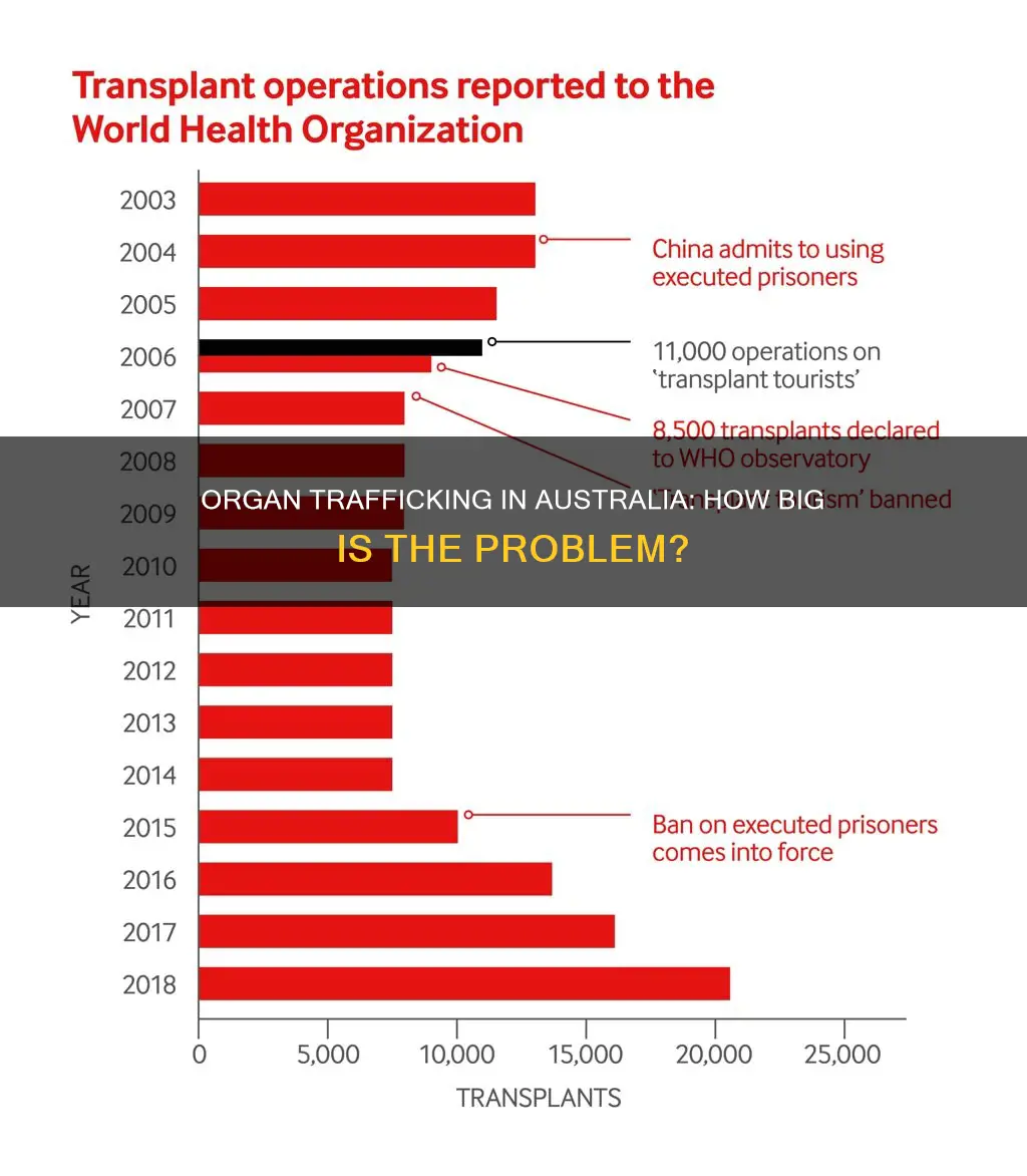 is organ trafficking big in australia
