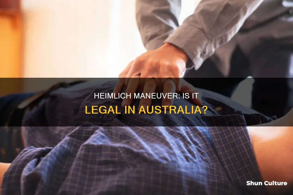 is the heimlich maneuver illegal in australia