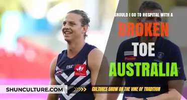 Broken Toe in Australia: When to Seek Hospital Treatment