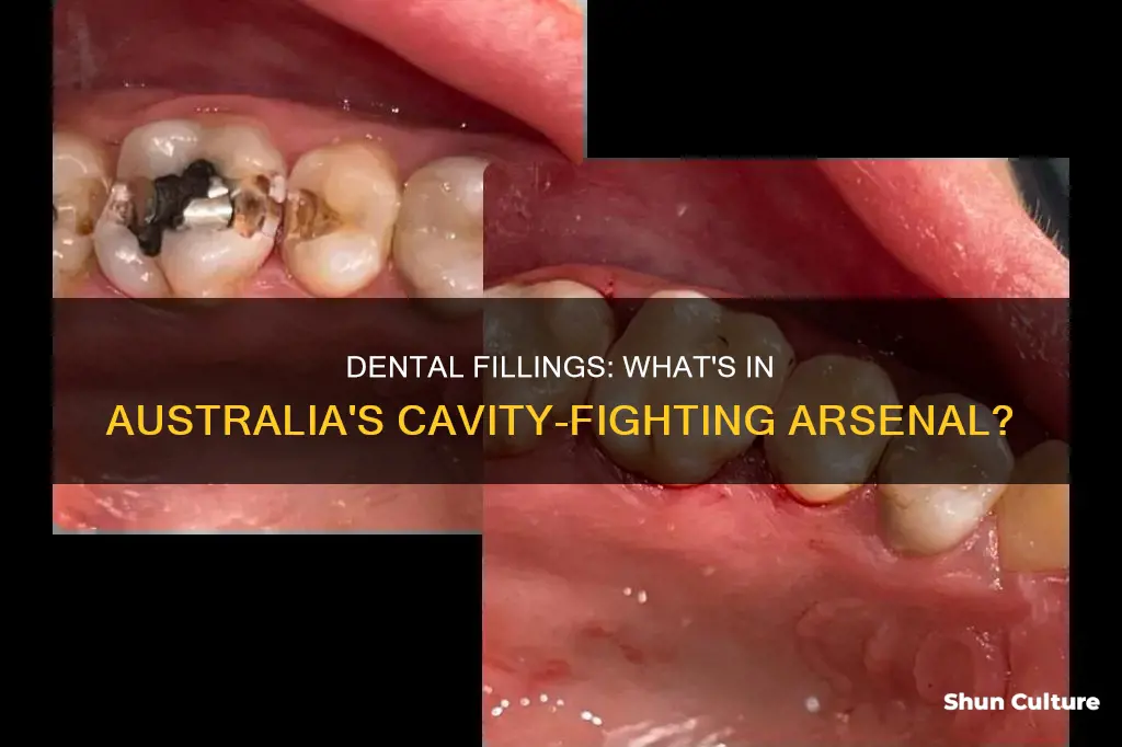 what are fillings made of in australia
