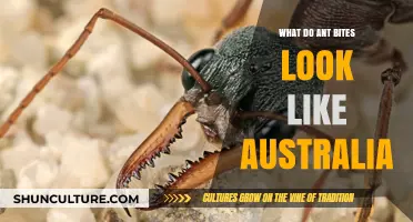 Ant Bites in Australia: What You Need to Know