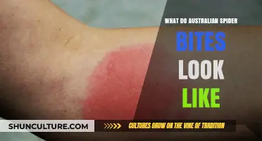 Spider Bites in Australia: What You Need to Know