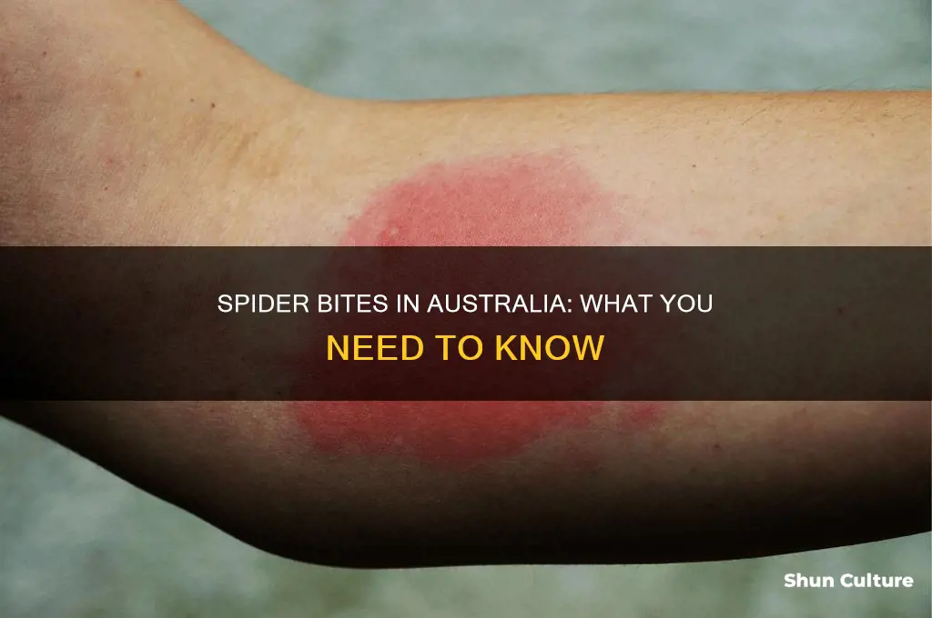 what do australian spider bites look like