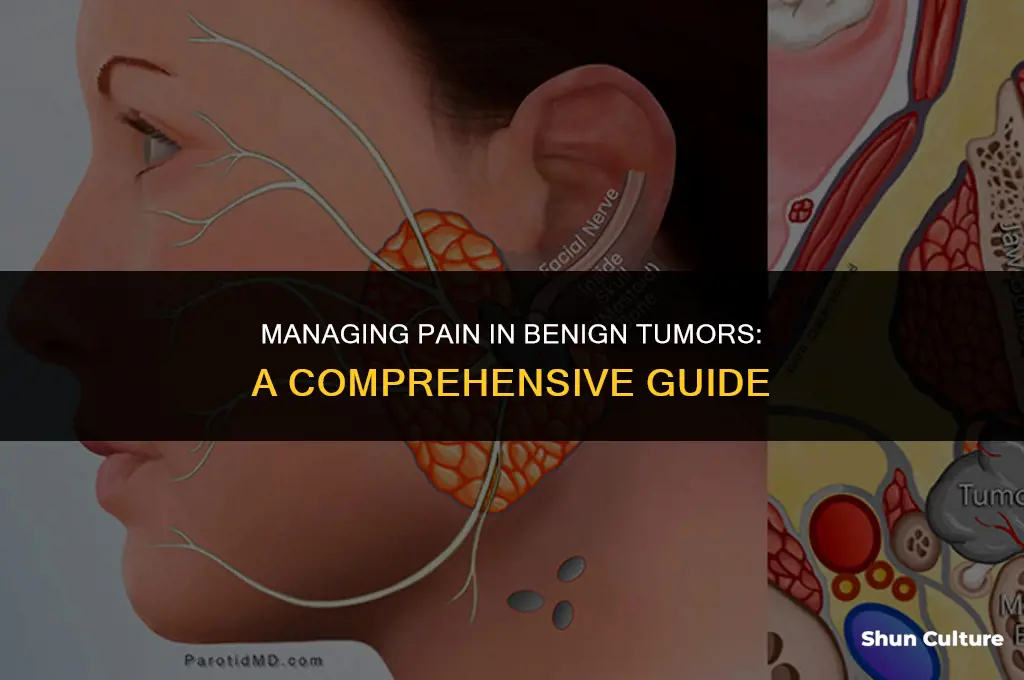 what do do about pain in a benin tumor