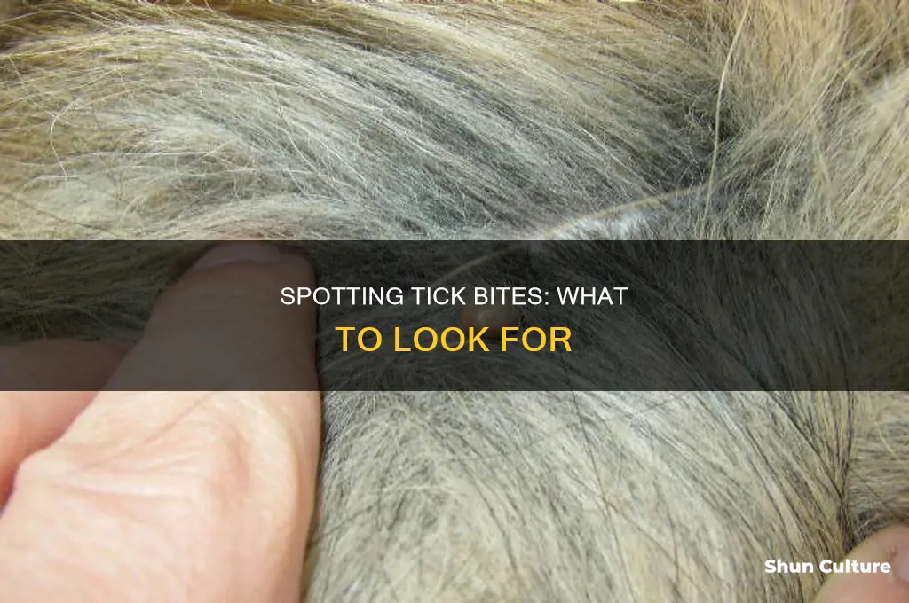 what do tick bites look like australia