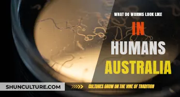 Worm Infections in Australia: What You Need to Know