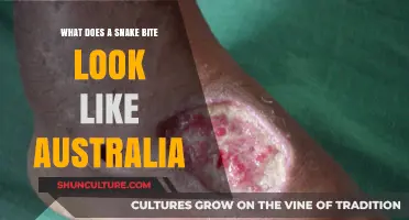 Deadly Australian Snake Bites: What You Need to Know