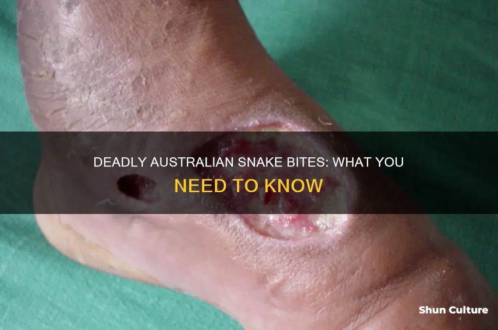 what does a snake bite look like australia