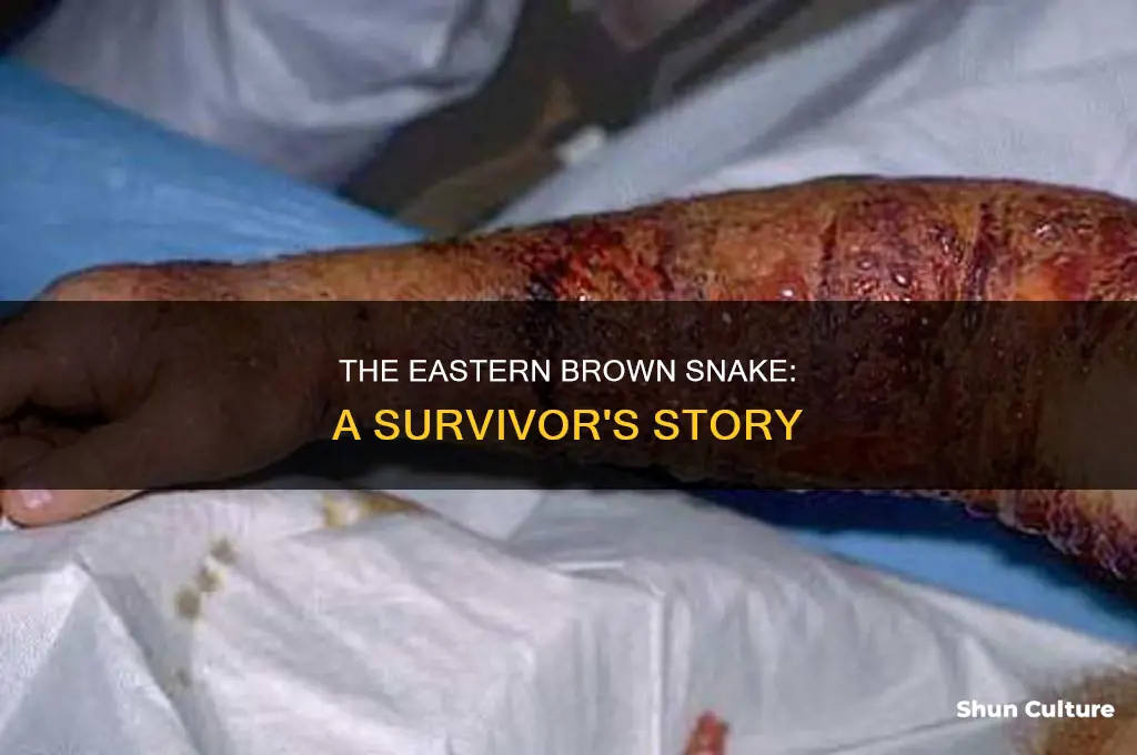 what does an australian eastern brown snake bite feel like