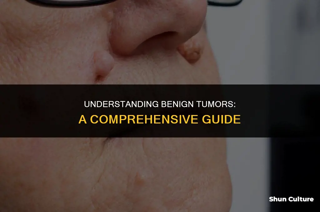 what is a benin tumor