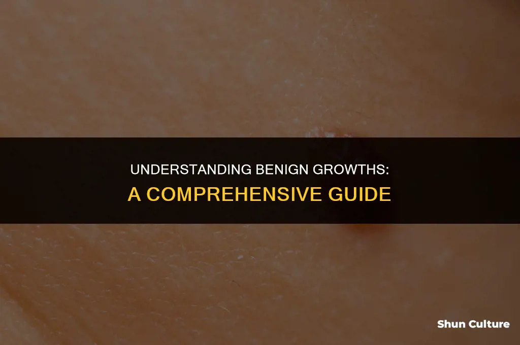 what is a benine growth