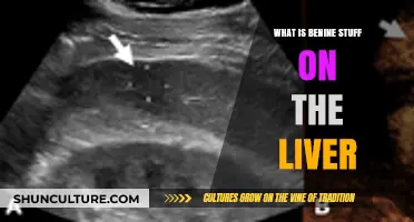 Understanding Benign Liver Lesions: A Comprehensive Guide