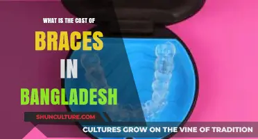 Affordable Braces in Bangladesh: Cost, Types, and Treatment Options